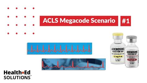 ACLS Megacode Scenario 1: Supraventricular Tachycardia (SVT).